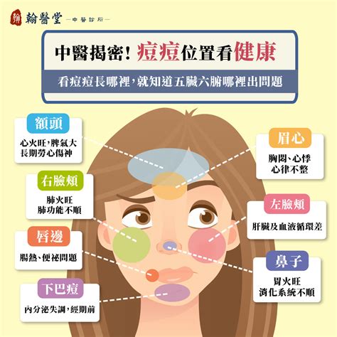 痘痘位置|9種「痘痘位置」透露你的身體狀況！額頭冒痘可能是。